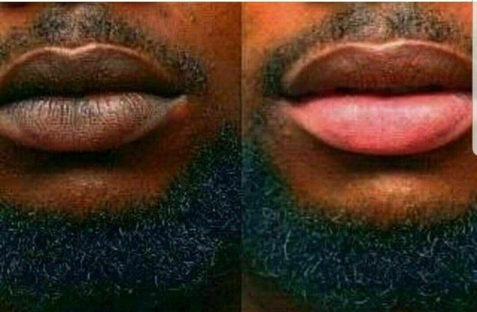 NicoLips Lip Scrub Balm Lightening Brightening Dark/Smoker Lips 20g - Image 1 of 4