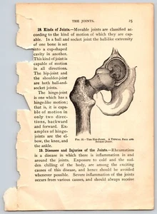 The Hip Joint Ephemera Human Anatomy Scientific Illustration Biology - Picture 1 of 2