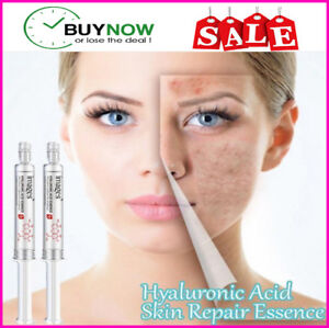 Hyaluronic Acid Skin Repair Essence 100% removes Acne Scars & Scars /an