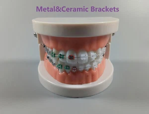 1Pcs Dental Orthodontic Treatment Model With Ceramic/Metal Brackets Study Model - Picture 1 of 5