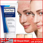 156g PanOxyl Mild Moisturizing foam Oil Control Moisturizing Facial Cleanser