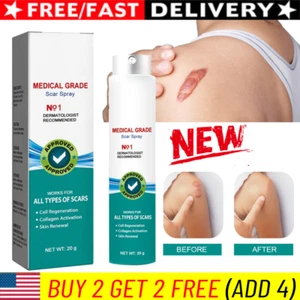 Scar Removal Spray Medical Grade Smoothing for Pregnancy Surgical Scars Burns~ - Picture 1 of 9