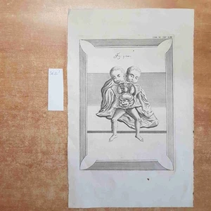 INCISIONE STAMPA '800 anatomia umana medicina OTTOCENTO 37 X 23 cm - Foto 1 di 2