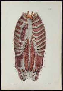 1866 - Angiology & Arteries Prosthesis - Lithography (Anatomy & Medicine) - Picture 1 of 3