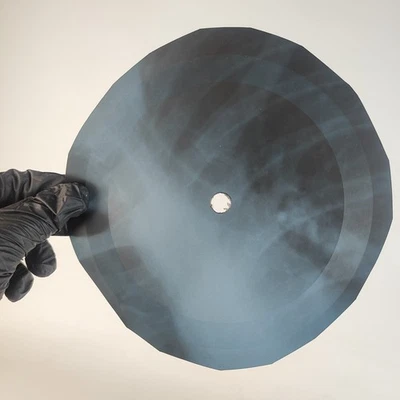 DAVID BOWIE PLEASE MRS GRAVEDIG X-Ray USSR Record Roentgen Bone Ribs Music Vinyl - Image 1 of 2