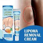 1pcs FatKnot Body Care Ceam for fat lumps Relief 20g New Sale