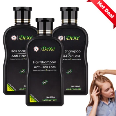 Anti Hair Loss Shampoo 200 ML Hair Growth Treatment Care For Men & Women Herbal - Image 1 of 4