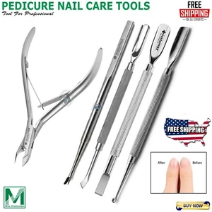 CUTICLE NIPPER PUSHER INGROWN TOENAIL LIFTER PEDICURE NAIL CARE TOOLS (5 PC) - Picture 1 of 6