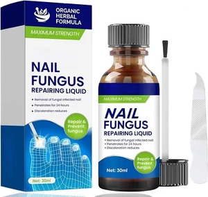 Fungal Nail Treatment Extra Strong – Repair for Toenail & Fingernail – 30ml - Picture 1 of 7