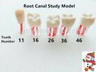 5 szt. Zęby kanałowe zębowe Badanie Praktyka Model do endodontycznego pilnika miazgi trzonowej