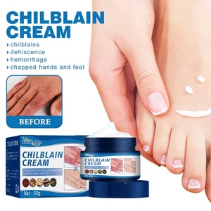 30ml Chilblain Cream Anti-cracking Frostbite Moisturiser Deep Nourishing - Picture 1 of 11