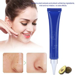 20g Face Freckle Removal Cream Lightening Age Spots Freckles Whitening Facia BBY - Picture 1 of 11