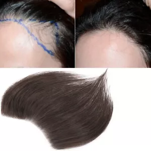 Invisible Skin PU Tape In Human Hair Toupee Frontal Hairline Forehead Hairpiece - Picture 1 of 13