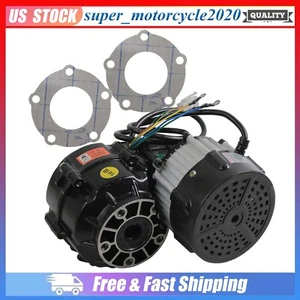 48V 1000W Electric Brushless Differential Motor For Go Kart ATV Buggy Tricycle - Picture 1 of 13