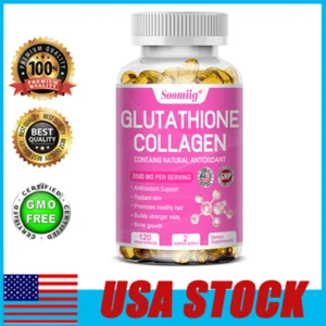 Cápsulas Blanqueadoras de Glutatión 2000mg - Antioxidante, Prevenir la Caída del Cabello - Imagen 1 de 10