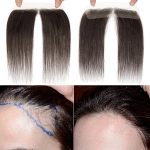 Full Lace Base 100% Remy Human Hair Patch Hairpiece for Front Hailine Hair Loss - Picture 1 of 16