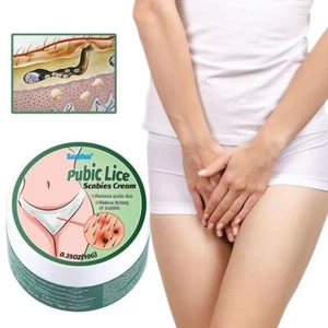 Pubic Lice Scabies Cream Antibacterial Lice Removal Ointment Antimite 9CJ7 - Imagen 1 de 9