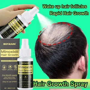 Tratamiento de regeneración del cabello extra fuerte para hombres, solución tópica para pérdida de cabello 60 ml - Imagen 1 de 12