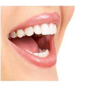 Very Strong Teeth Whitening Refill Gels No:36 Professional Grade, Strong bleach