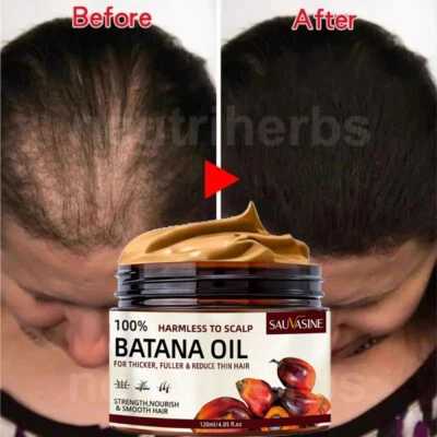 Acondicionador de aceite de batana orgánico natural para crecimiento rápido del cabello, reparación del cabello dañado Foto 1 de 4