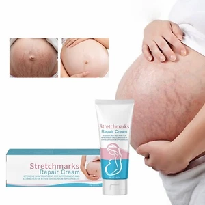 Stretchmarks Repair Cream Stretch Marks Removal Fat Stretch Mark 60g - Picture 1 of 13
