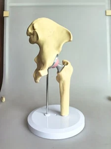 Reemplazo de articulación de cadera artificial tamaño 1:1 modelo demo esqueleto anatómico médico - Imagen 1 de 17