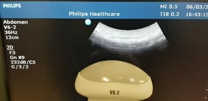 philips V6-2 convex 4D Ultraschallsonde Wandler Ultraschallsonden Transductor - Bild 1 von 11