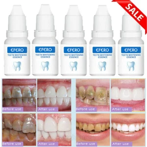 5x TEETH WHITENING LIQUID GEL, STAIN REMOVER TOOTH WHITENING BLEACHING KIT 10ML - Picture 1 of 14