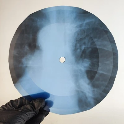 DAVID BOWIE SONG FOR BOB DYLAN X-Ray USSR Record Roentgen Bone Ribs Music Vinyl - Image 1 of 2