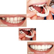 Nap on smile Sorriso dei denti Flessione dei denti dentiera Copertura dentale