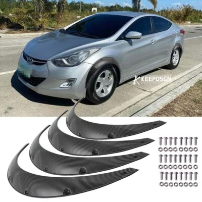 4x Fender Flares Extra Wide Wheel Arches Flexible 3.5" 4pcs For Hyundai Elantra — 第 1/4 张图片