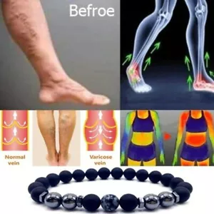 Anti-Swelling Obsidian Energy Bead Anklet Stretchy Weight Loss Magnet Bracelets - Picture 1 of 16