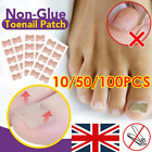 100 PCS Glue Free Toenail Toe Ingrown Nail Correction Patch Nail Stickers UK