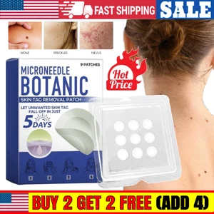 Microneedle Botanic Skin Tag Remover Patch natural herbal Removal Treatment - Picture 1 of 15