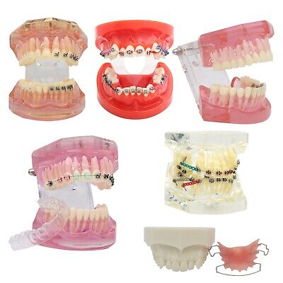 Dental Orthodontic Metal/Ceramic/Invisible Brackets Lingual Brace Teeth Model • 52.79$