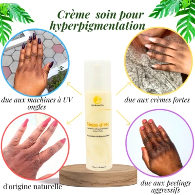 Hyperpigmentation Eraser Care Cream for Phalanges, Feet - Image 1 of 4