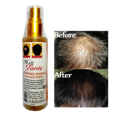TONIC HAIR GENIVE Create New replacement Improve Hair Appearance 120 ml.2X - Image 1 of 4