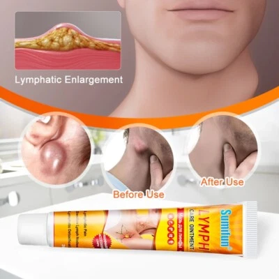 SUMIFUN Natural Breast Lymph Cream Lymphatic Drainage Ointment Neck Anti Swelling Detox
