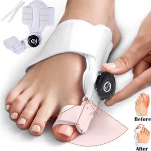 PREMIUM Corrector de juanetes para mujeres y hombres ortopédico férula ajustable - Imagen 1 de 30