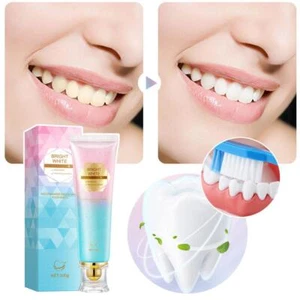 Niacinamide Whitening Toothpaste,Natural Niacinamide Toothpaste,Teeth Whitening- - Picture 1 of 12