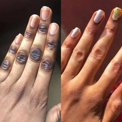 Dark spot Brightening Bleaching Lightening Face body Serum - Image 1 of 4