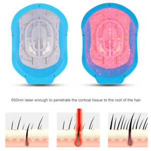 80 Diodes Laser Hair Loss Regrowth Growth Treatment Helmet Therapy Alopecia Cap - Picture 1 of 12