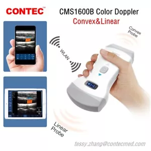 CMS1600B Wireless handheld dual-probe color Doppler ultrasound diagnostic system - Picture 1 of 17
