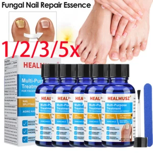 5/3Pcs Antibacterial Fungal Nail Treatment Nail Repair Essential Oil Nail Care - Picture 1 of 20