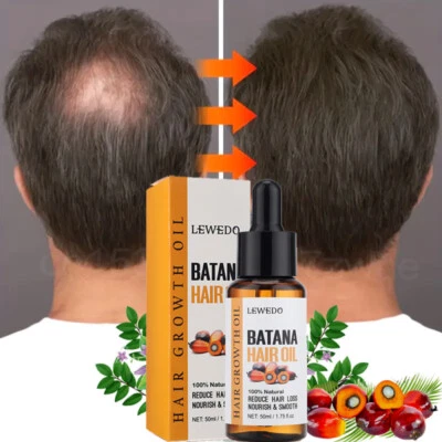 Suero de aceite de batana natural para el crecimiento del cabello más saludable más grueso más lleno anti pérdida de cabello Foto 1 de 4
