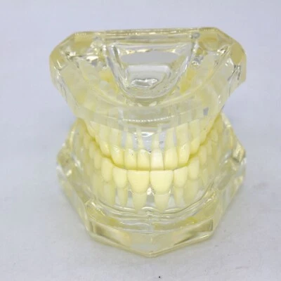 1×Transparent Plastic Study Teeth Model Demonstrate Comprehensive Repair Yellow - Image 1 of 4