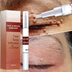 Skin Tags & Moles Removal Quick Safe Remover Restore Skin~ - Picture 1 of 6