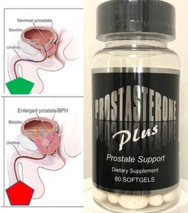 PROSTASTERONE MULTI VITAMIN MEN DIETARY SUPPLEMENT 60cap support formula - Picture 1 of 3