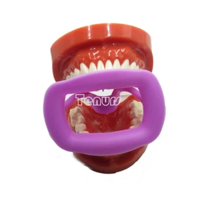 1X Newly Orthodontic Dental O Mouth Opener Intraoral Cheek Lip Retractor purple - Picture 1 of 10