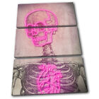 Skull Retro Neon Pink Vintage TREBLE CANVAS WALL ART Picture Print